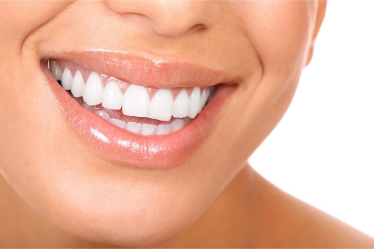 Top 10 over the counter teeth whitening